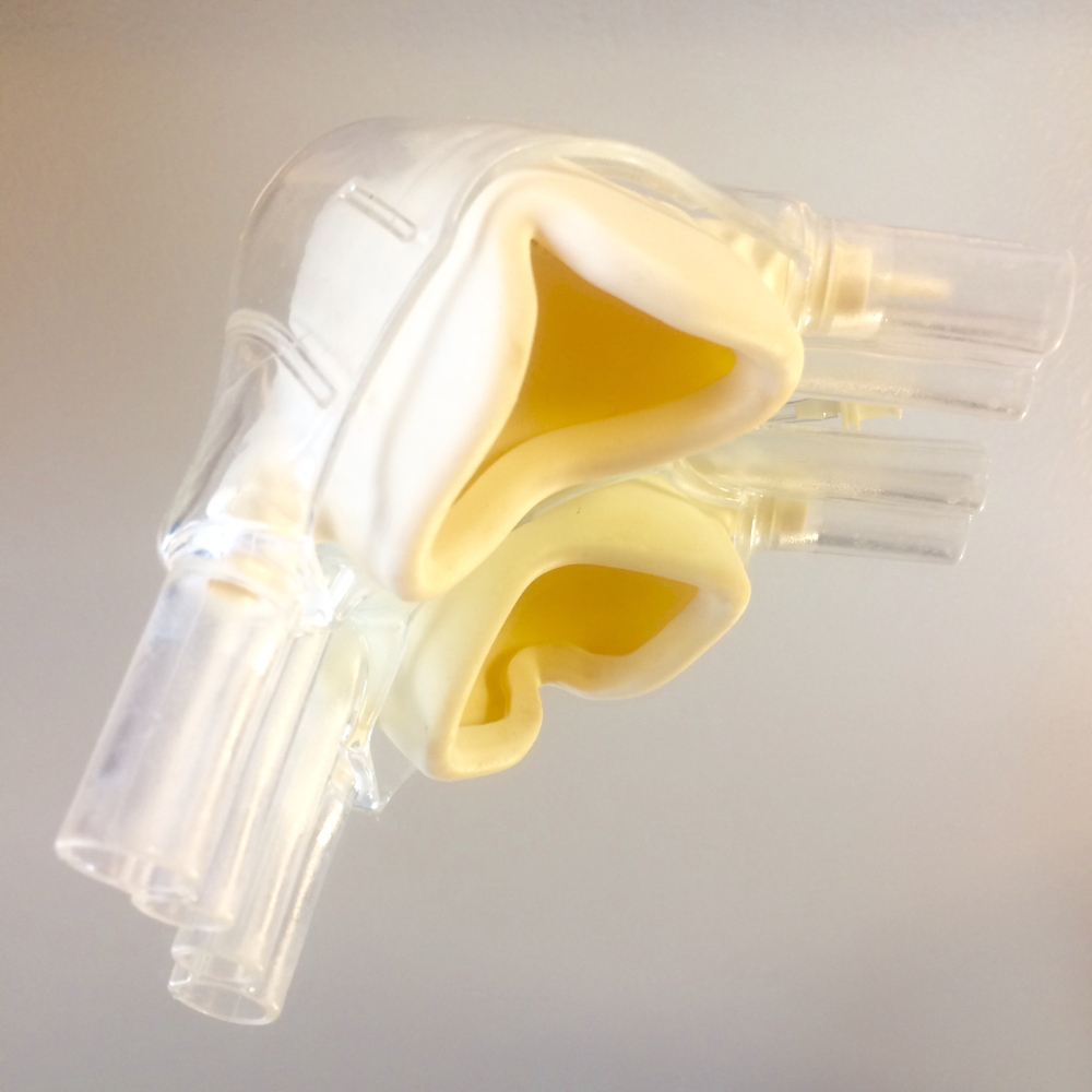 Intravenous (IV) Sedation